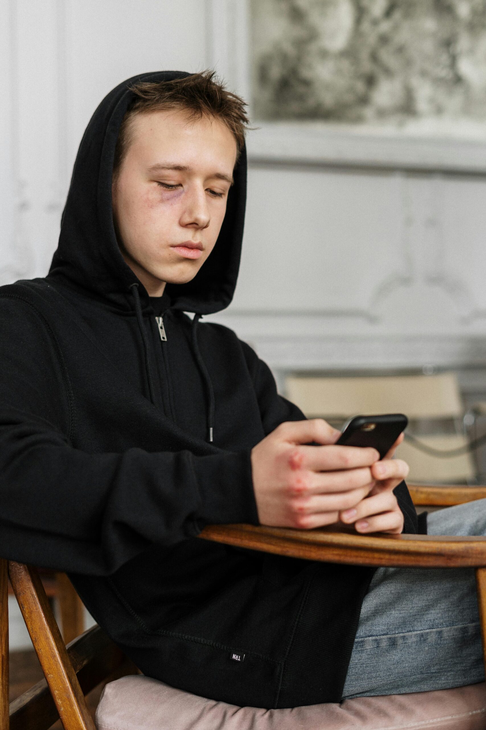 Teen boy in hoodie with black eye using smartphone indoors, focused expression.